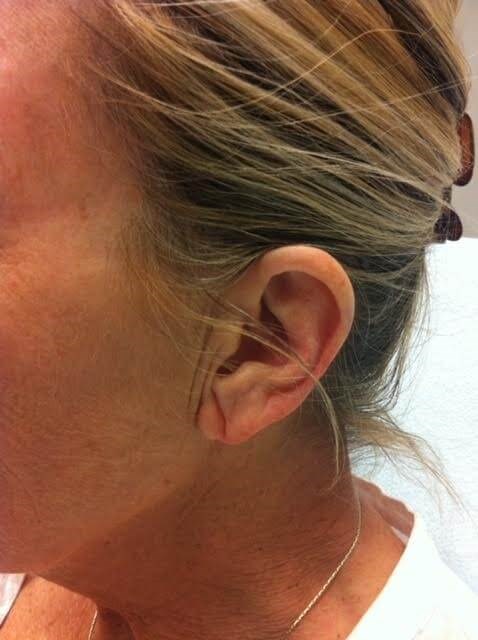 Before Image