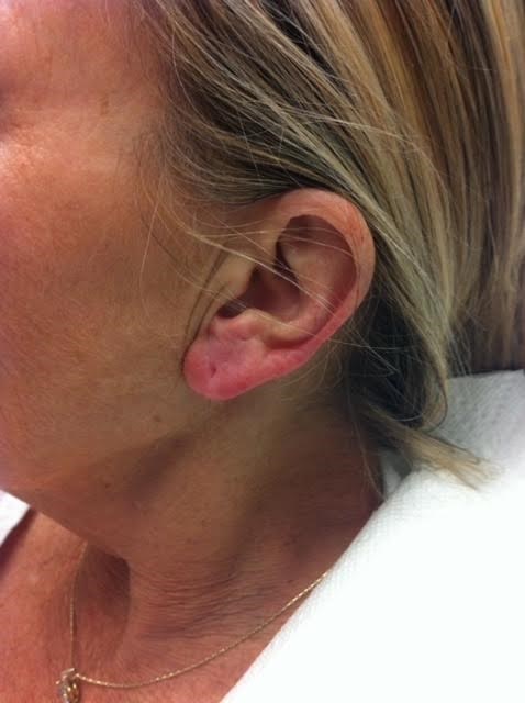 After Image