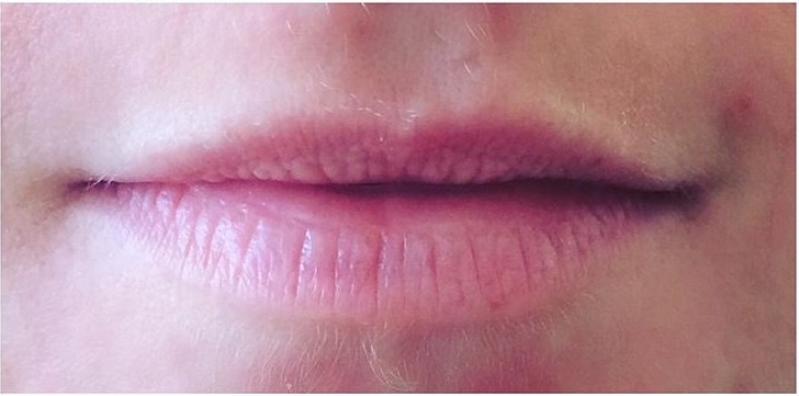Give Your Lips a 'Fuller' Look Before